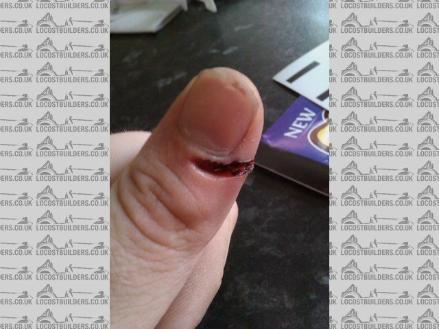 SoreThumb2