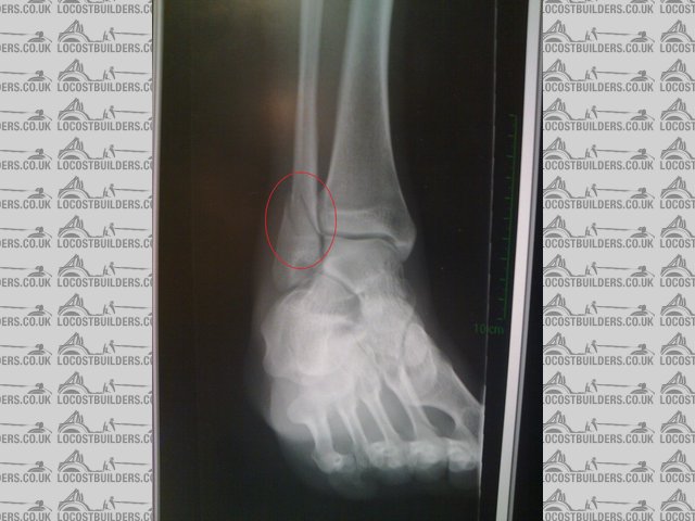 ankle