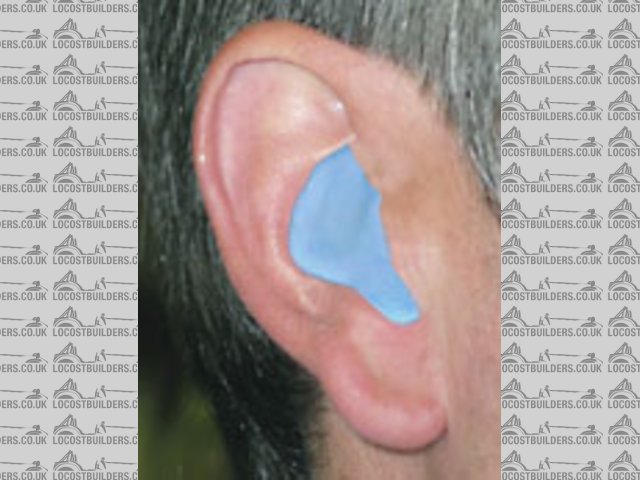 ear plug